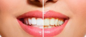 3 мифа о здоровье зубов
