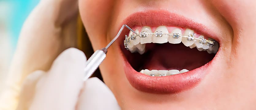Консультация стоматолога-ортодонта в Армавире
